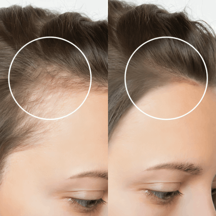 Lucinn Pro Filtered Showerhead customer review Deborah